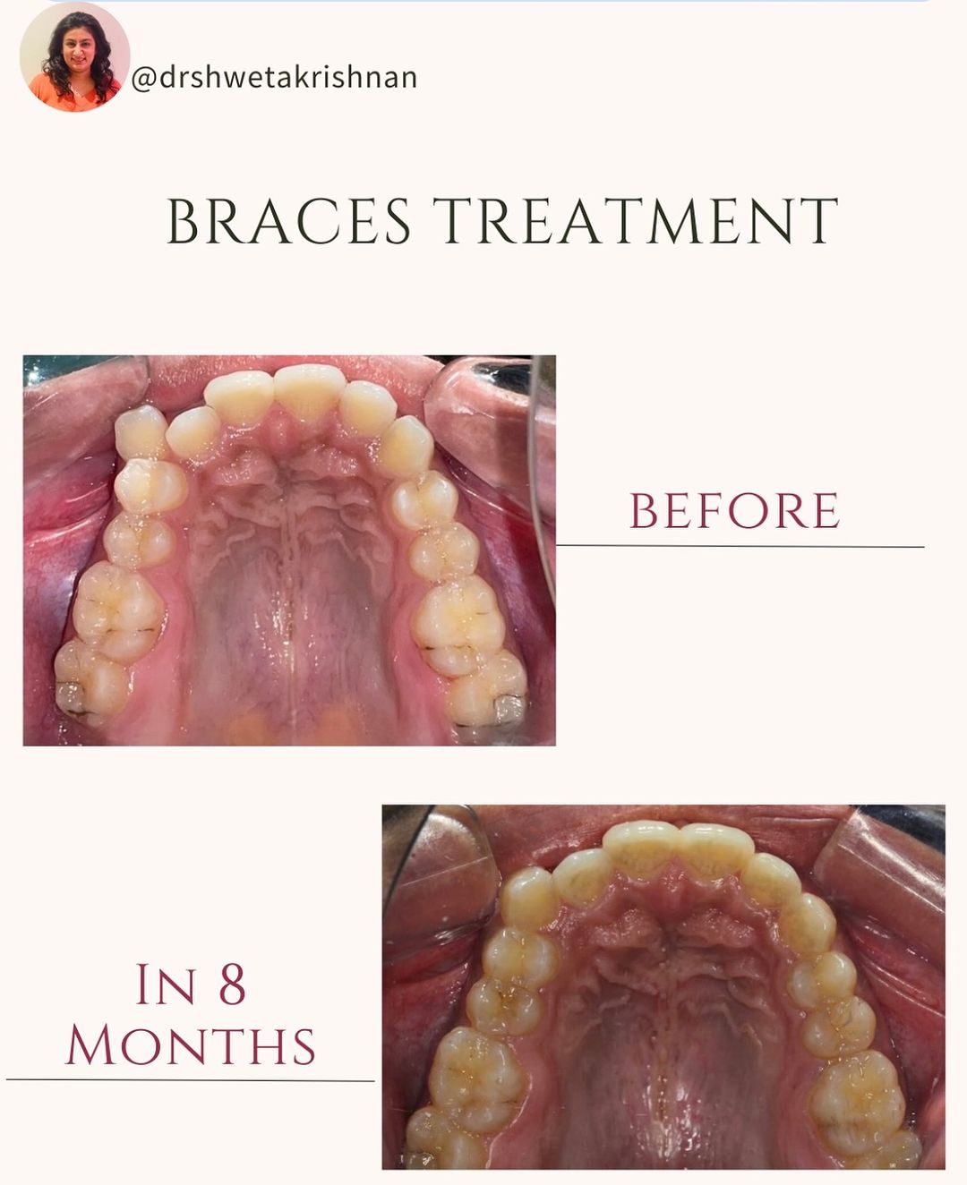 best dental clinic in kochi