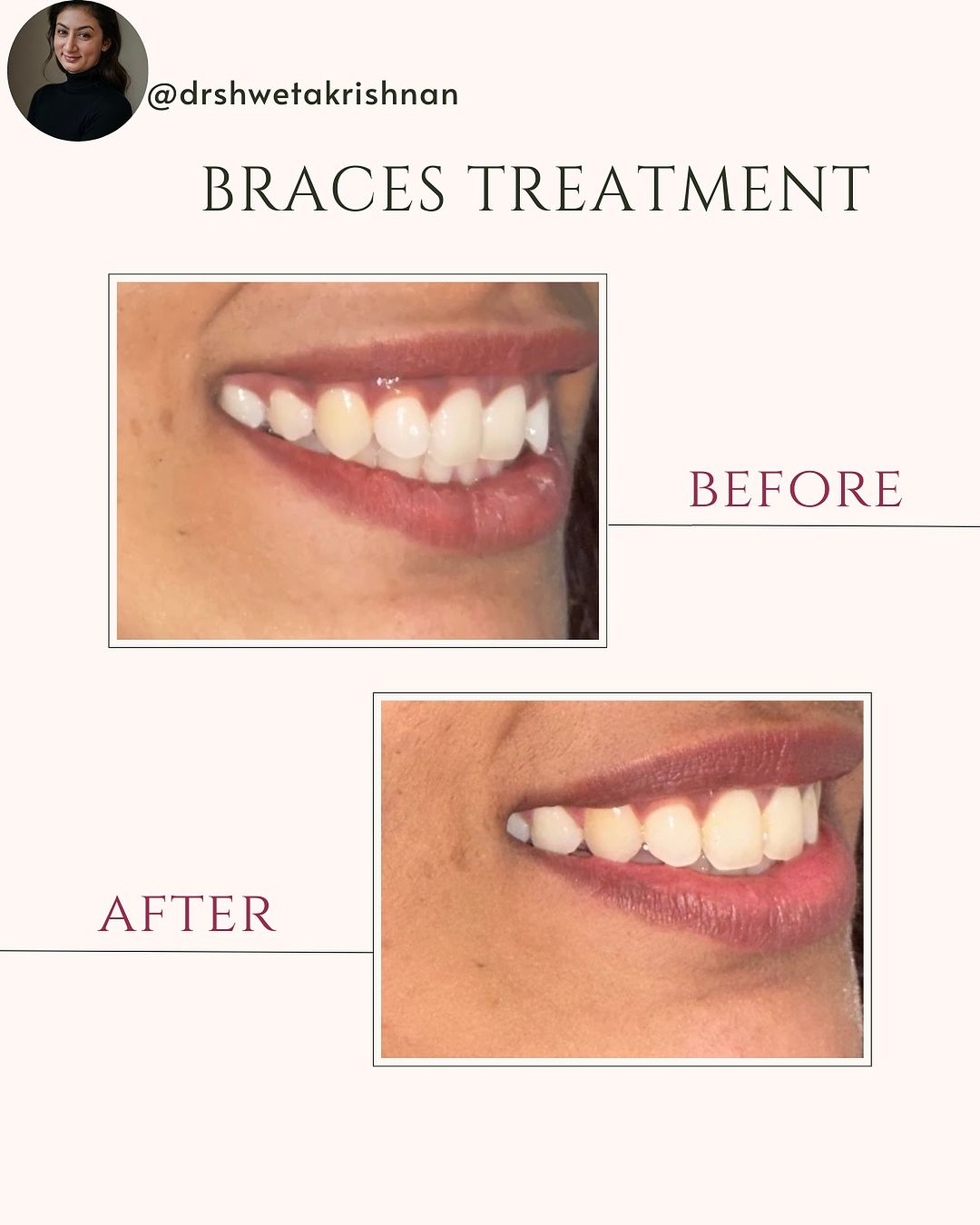 best dental clinic in kochi